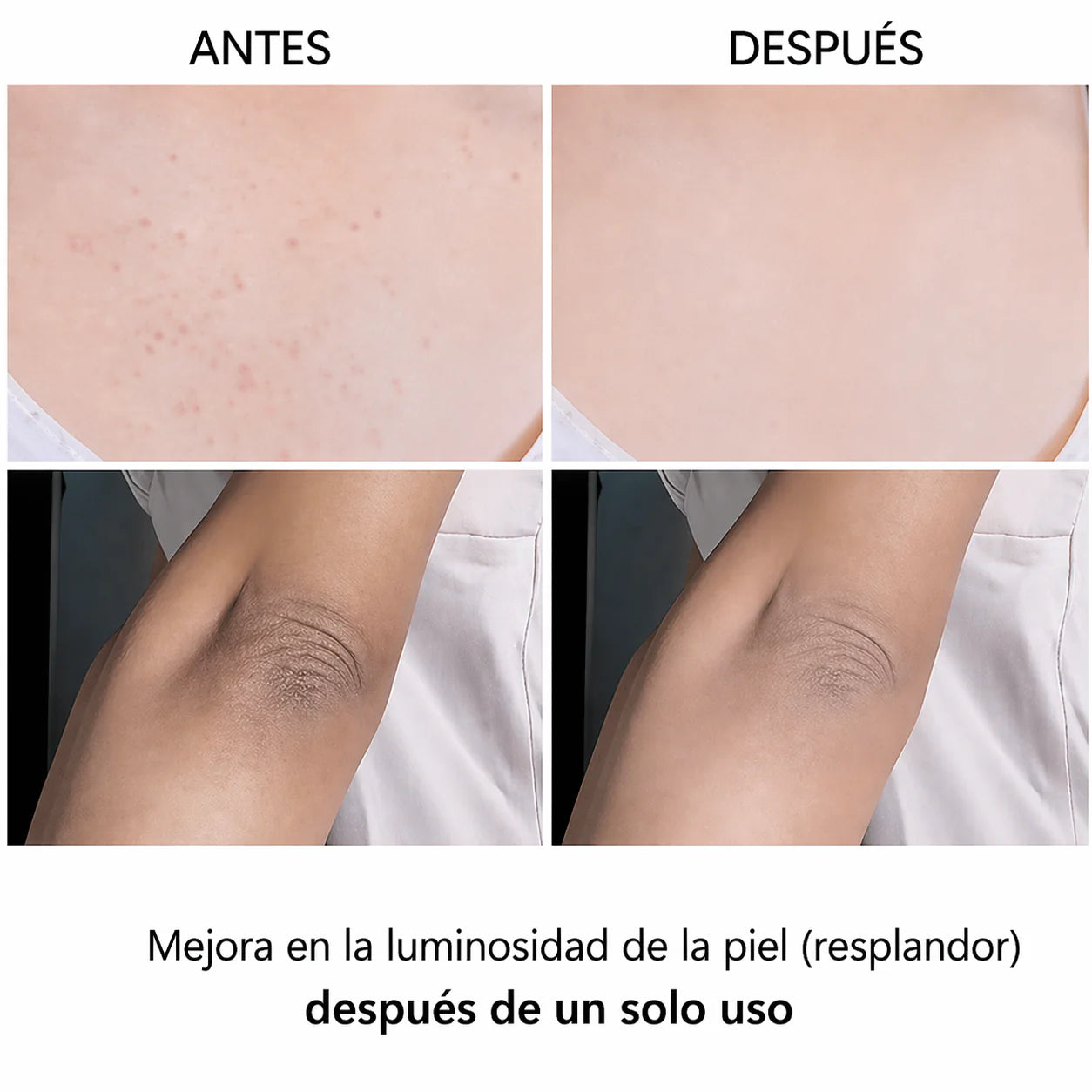 Dr. Melaxin® Quita Manchas | 46% OFF