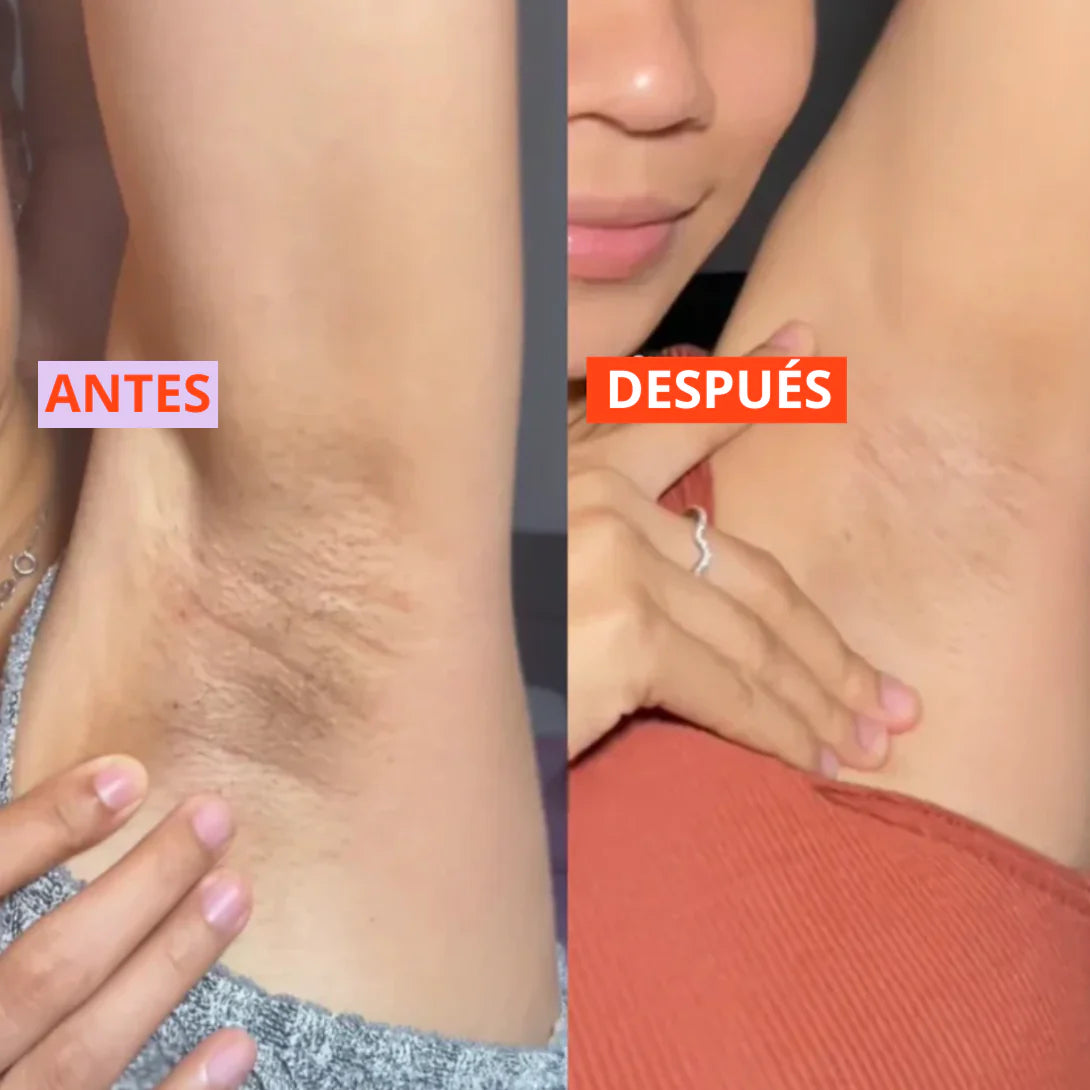 Dr. Melaxin® Quita Manchas | 46% OFF