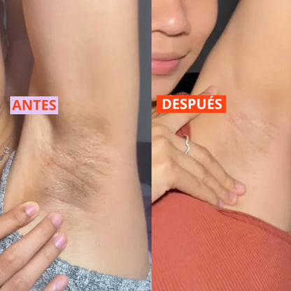 Dr. Melaxin® Quita Manchas | 46% OFF